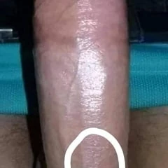  como👍 esta foto 