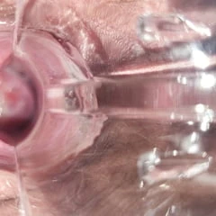 Speculum 