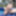 Wrinkled soles in the pool #2