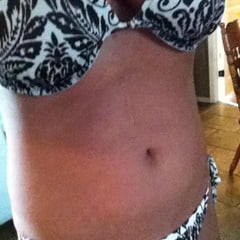 Hot body