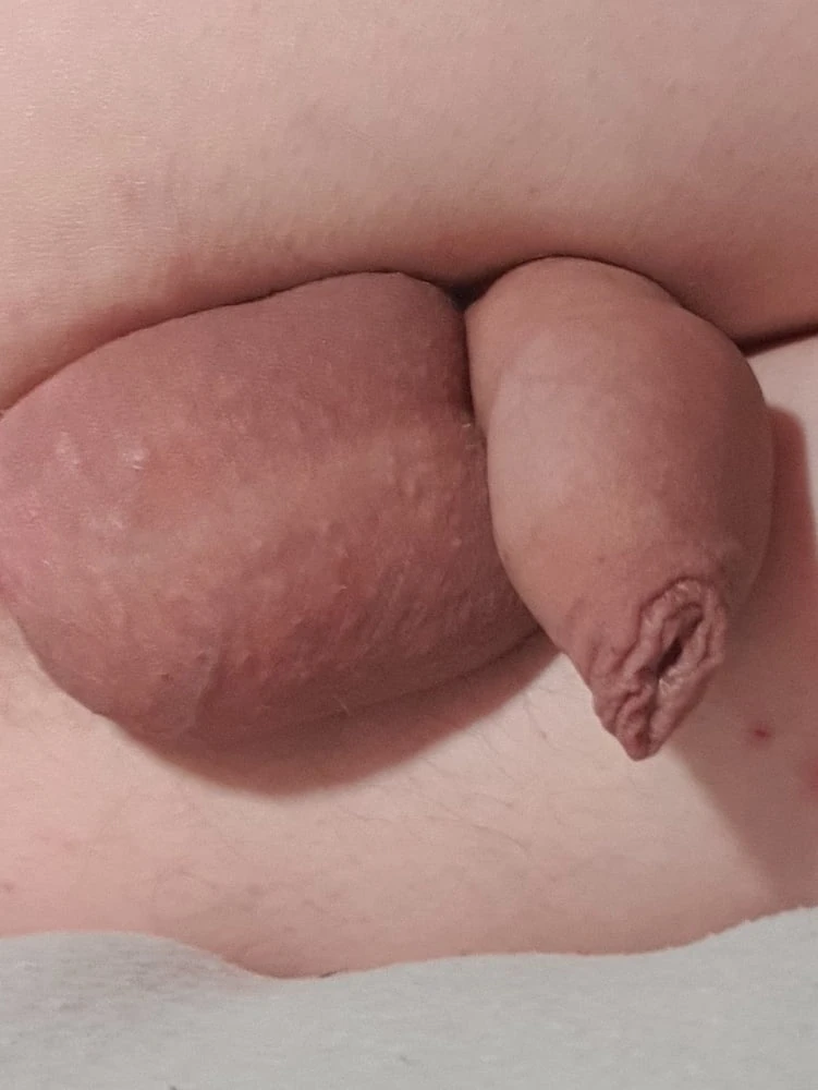 Das Problem mit meinem ewig schleimigen Pullerchen