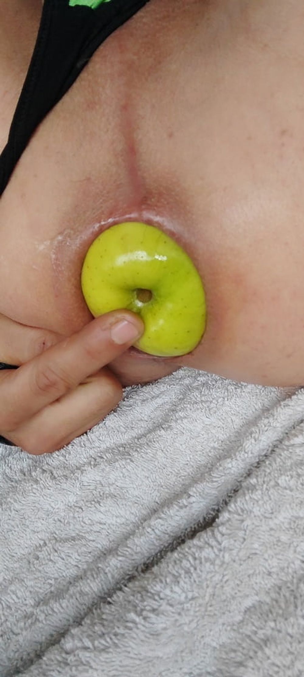 appel anal #11