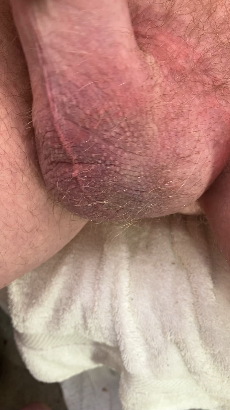 Compilation of uncut cock pics #13