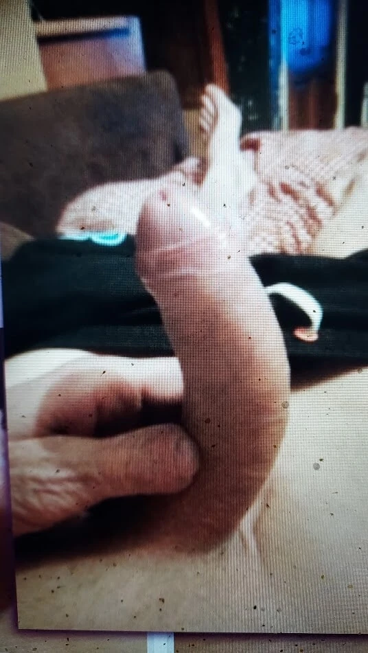 My penis 