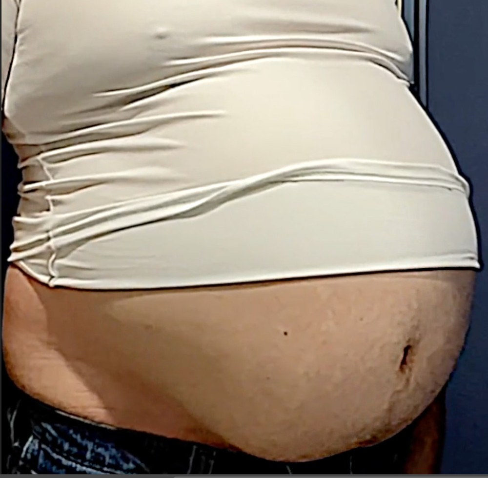 Ximd9000 Big Bloated Belly #15