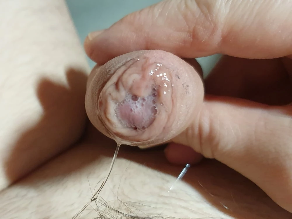 Das Problem mit meinem ewig schleimigen Pullerchen 9