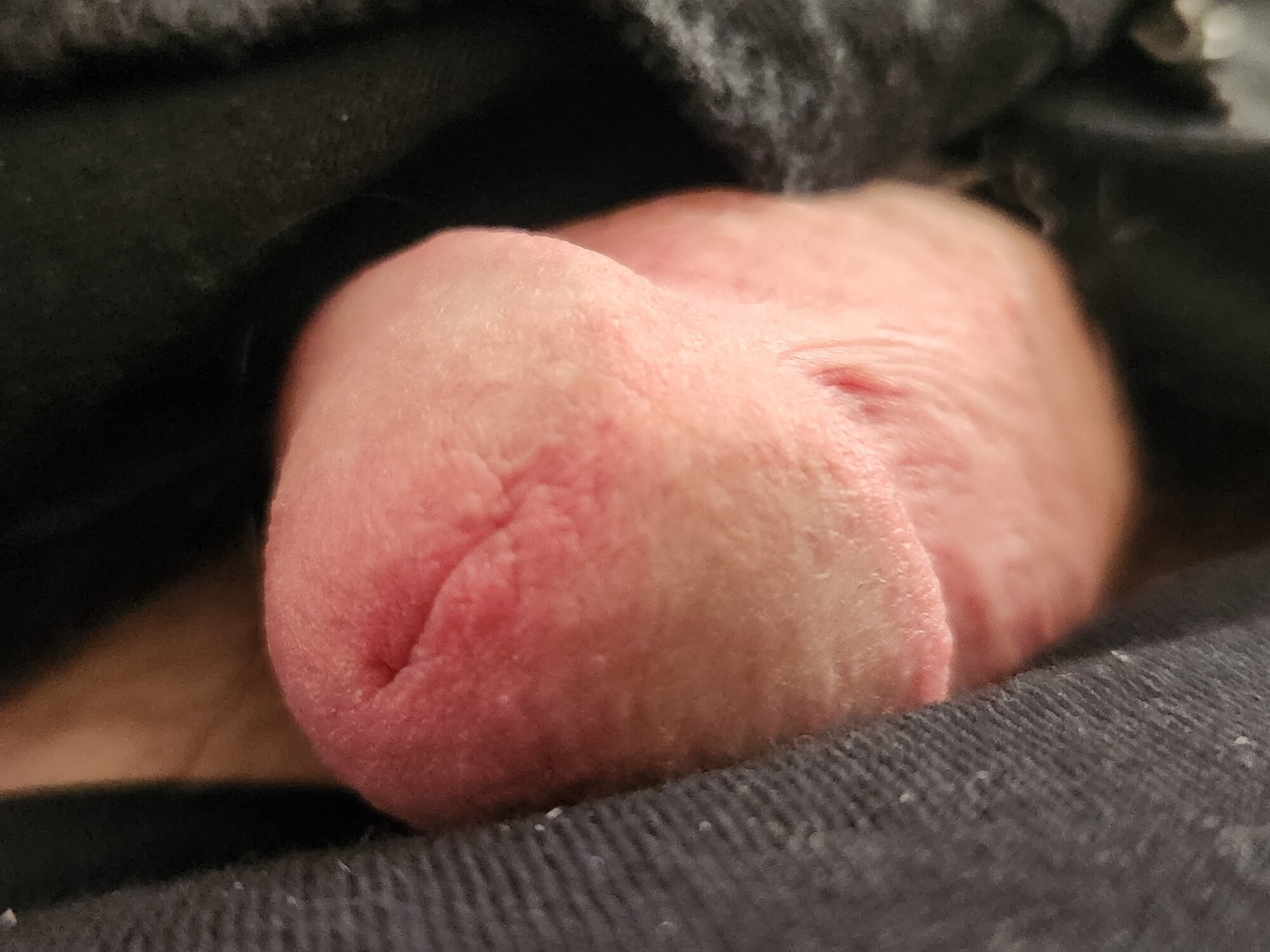 Cock eye 
