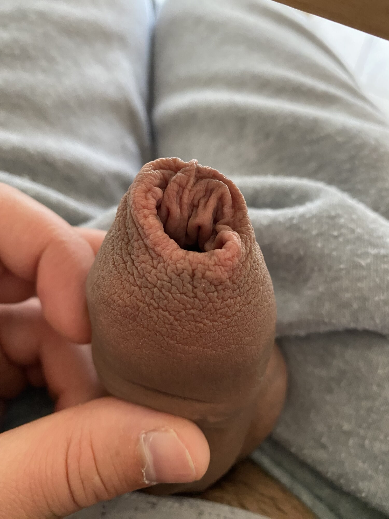 Broken foreskin porn