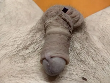 Limb cock banding