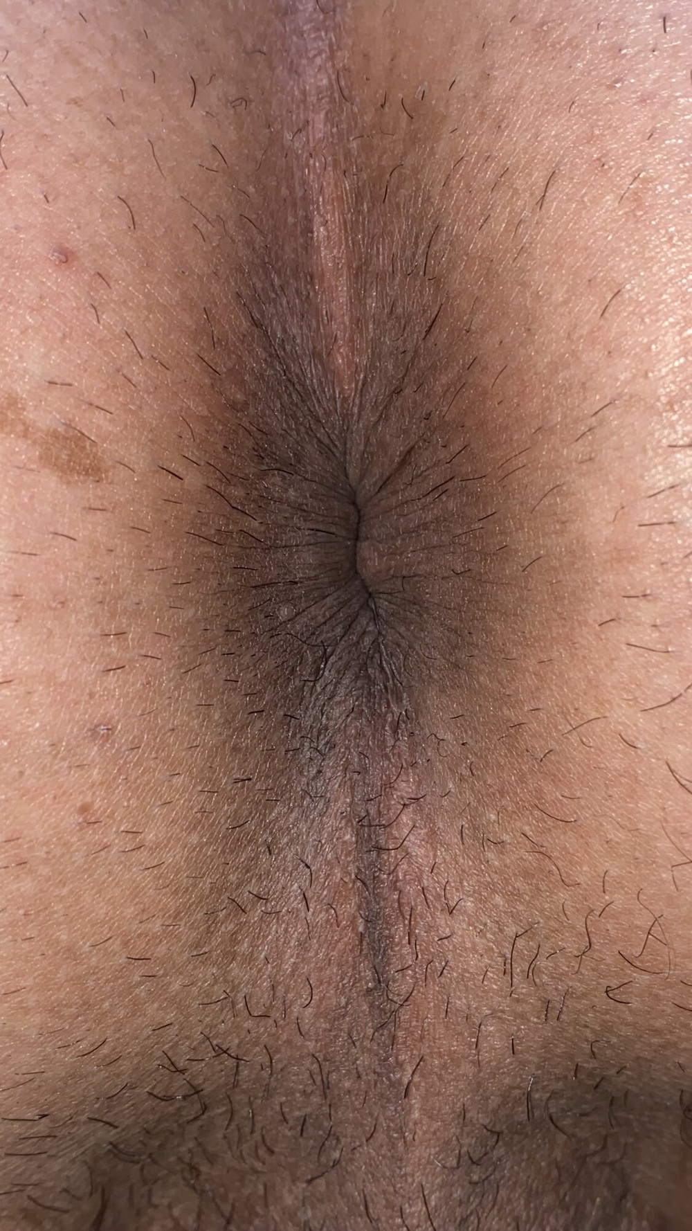 Close-up of a man&#039;s anus #16