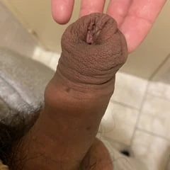 Foreskin after stretching porn