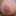 My nipples