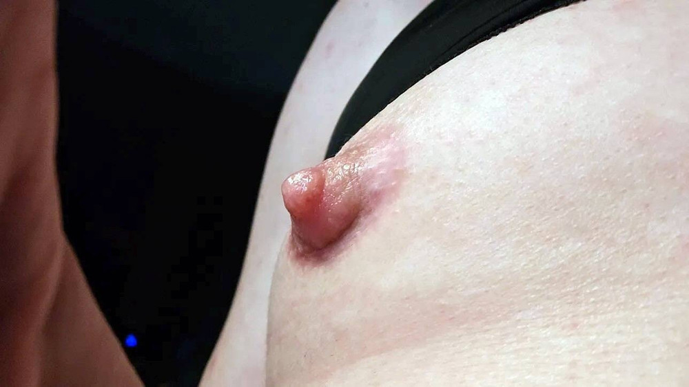 My nipples