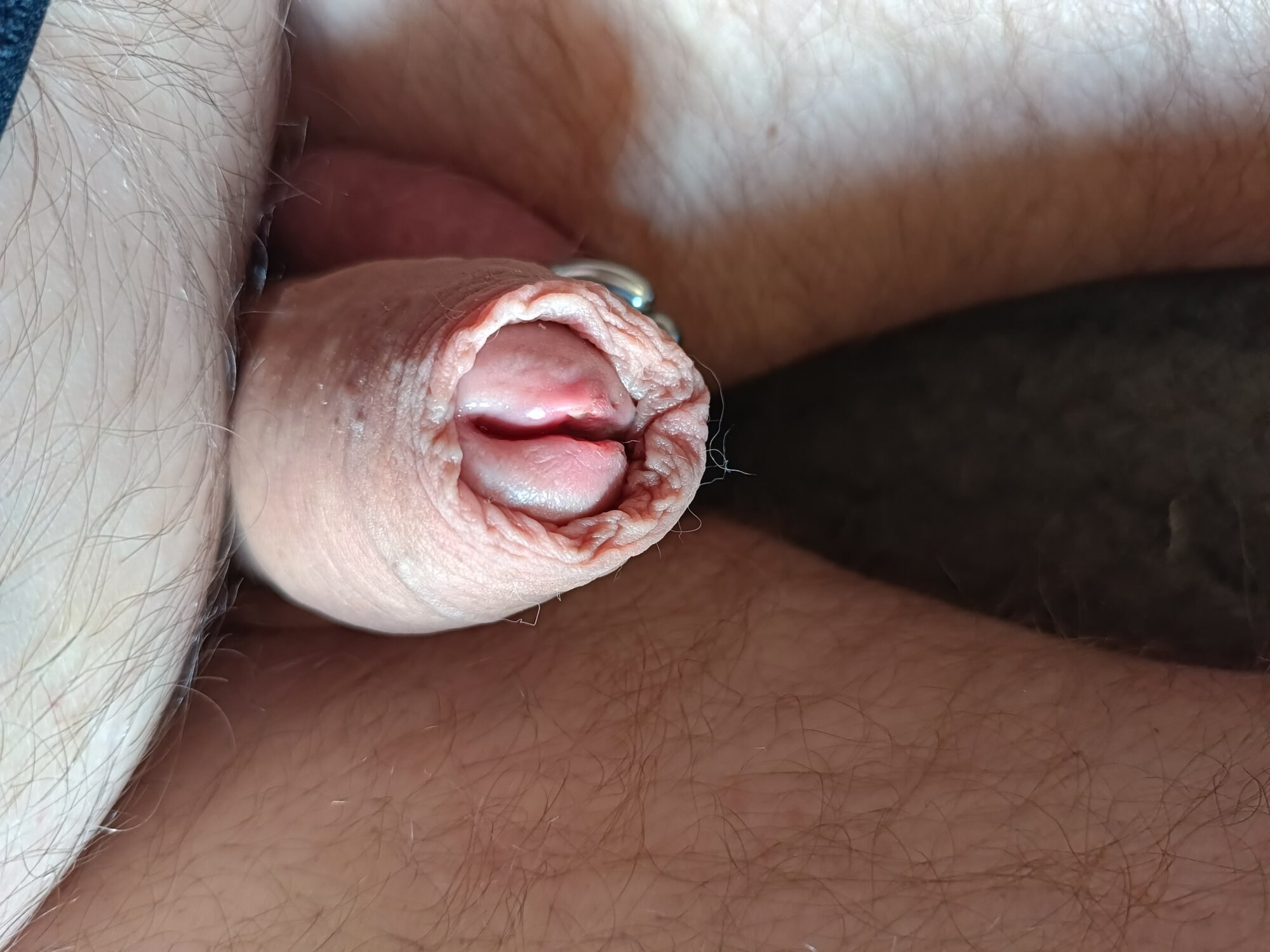 penis