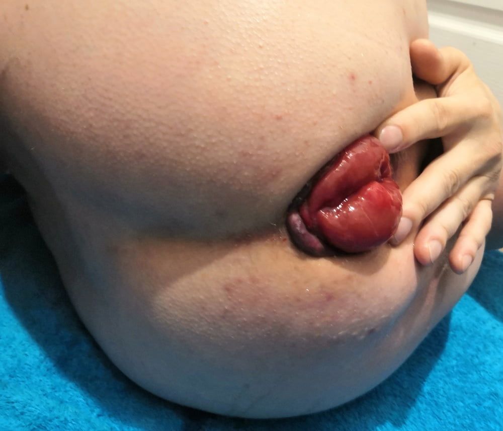 extreme prolapse pumping #7