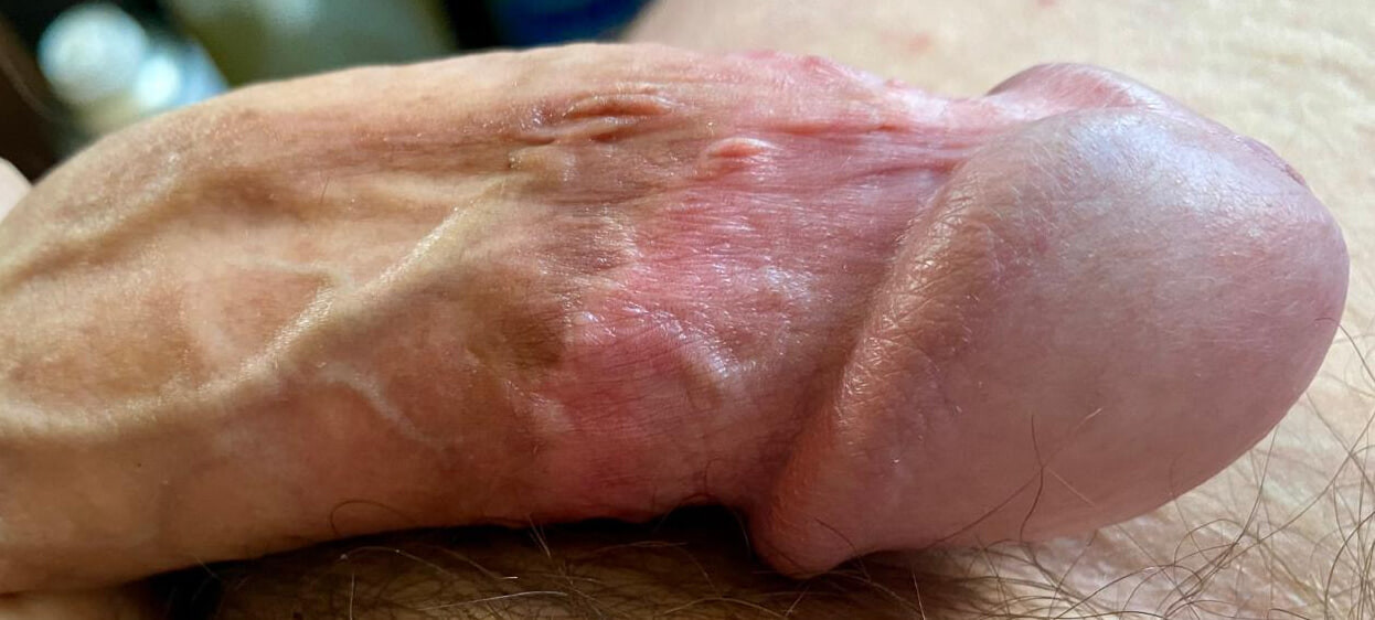 Needs attention #6