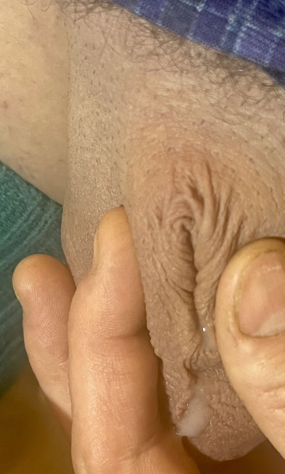 Micropenis lady, boy, cock pic #10