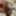 extended foreskin
