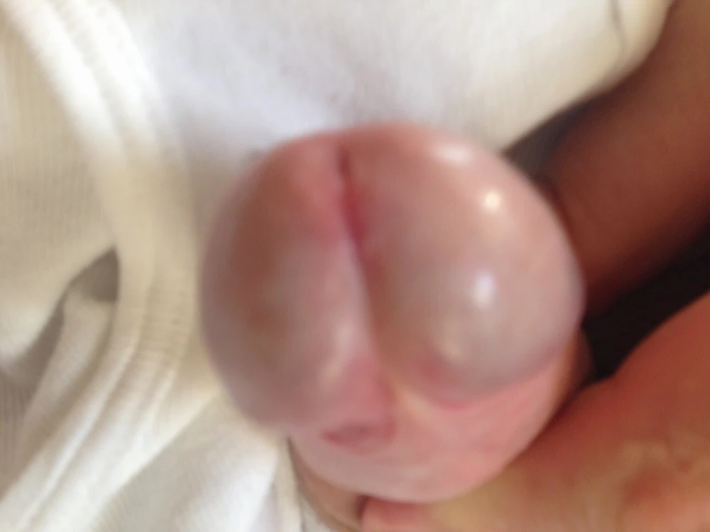 Micro penis #40