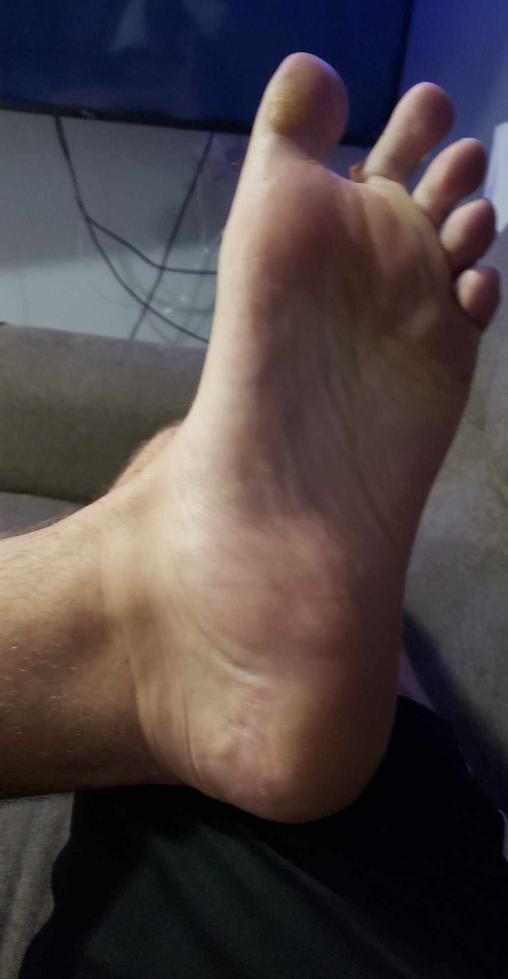 My Feet Pics as Requested.  Opinions?