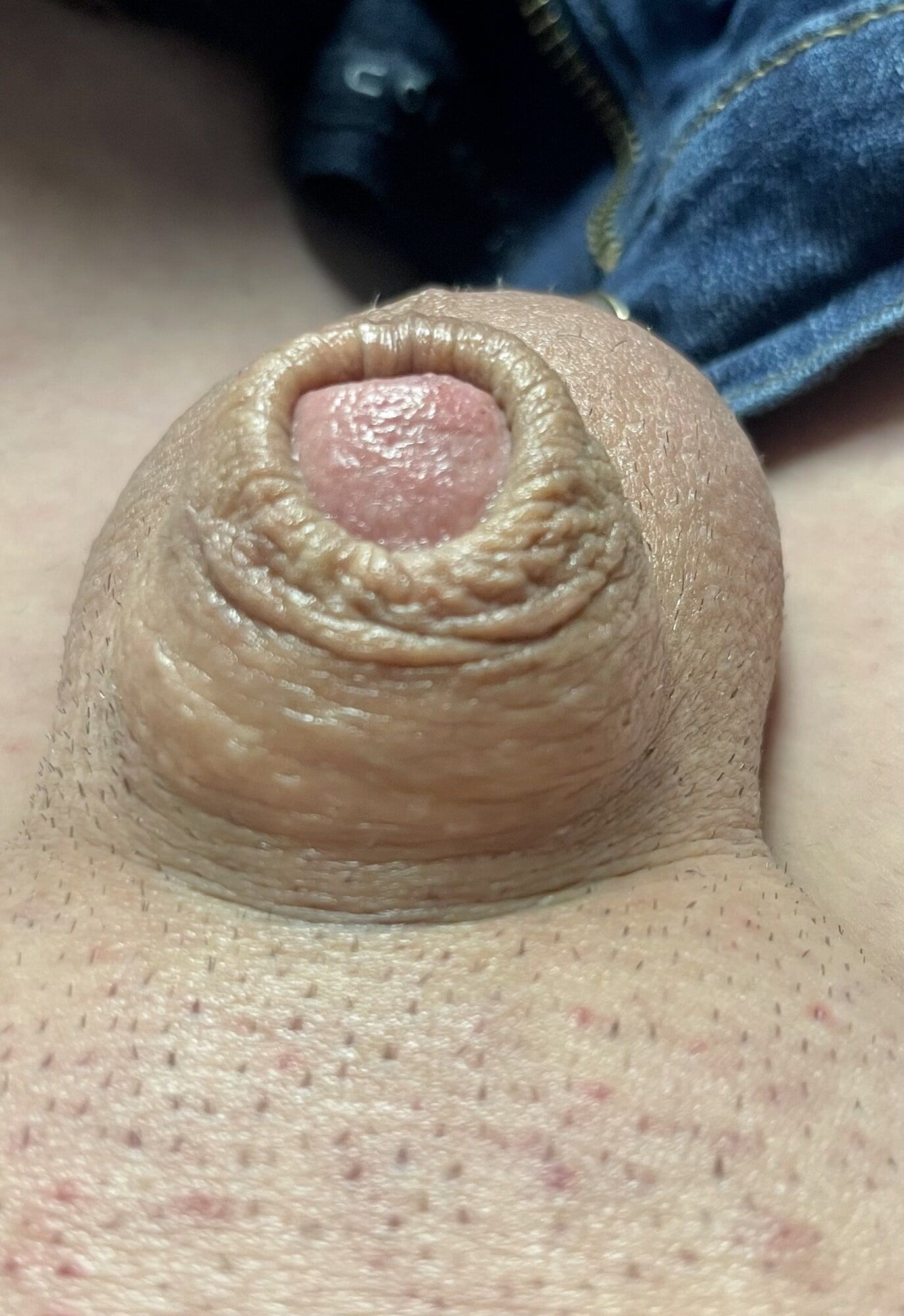 Inverted tiny penis #2