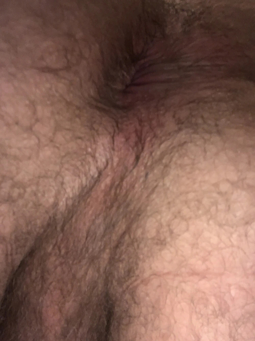 Pic2 #3
