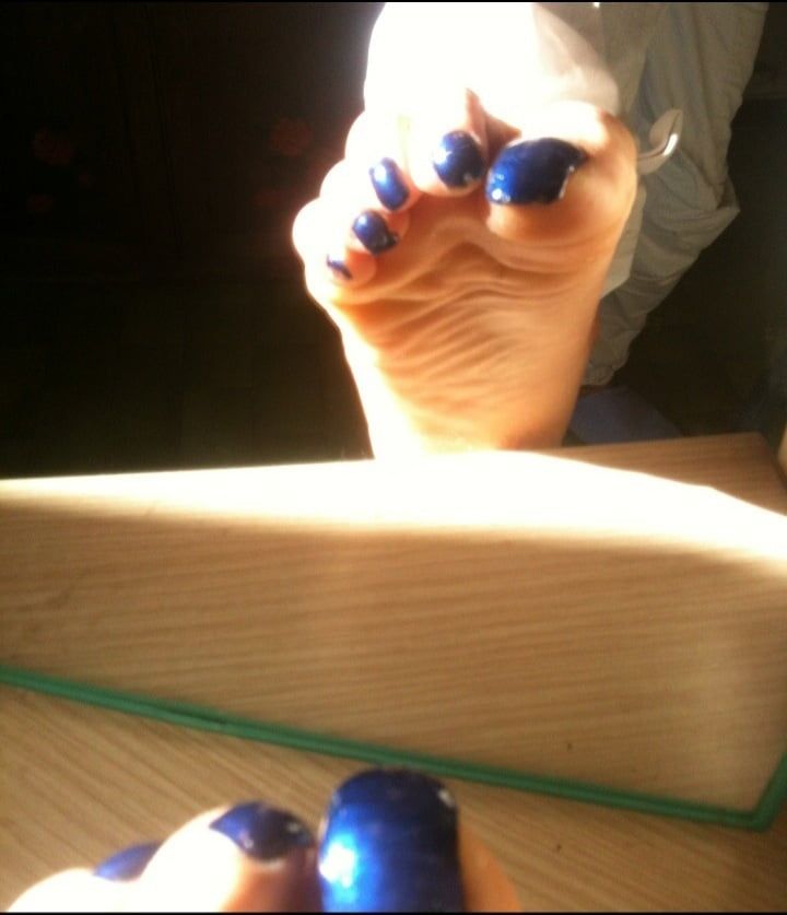 Blue toenails under sun ray #9
