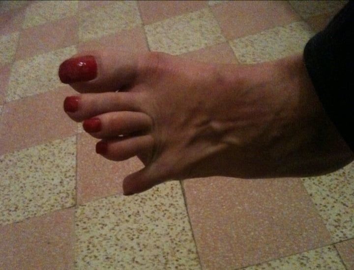 red toenails mix (older, dirty, toe ring, sandals mixed). #28