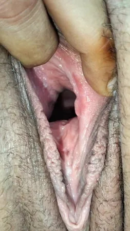 cum covered cervix         