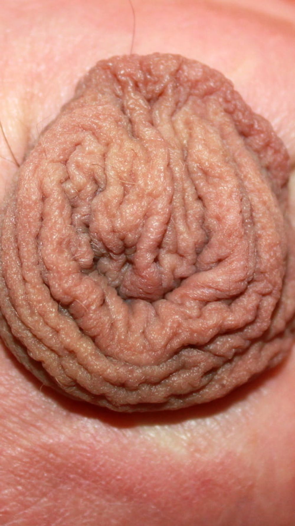 My foreskin #11