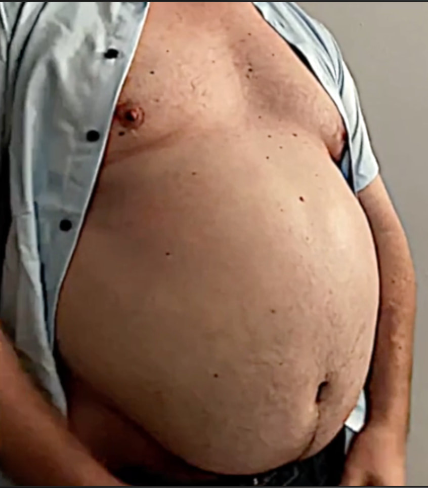 Ximd9000 Big Bloated Belly #11
