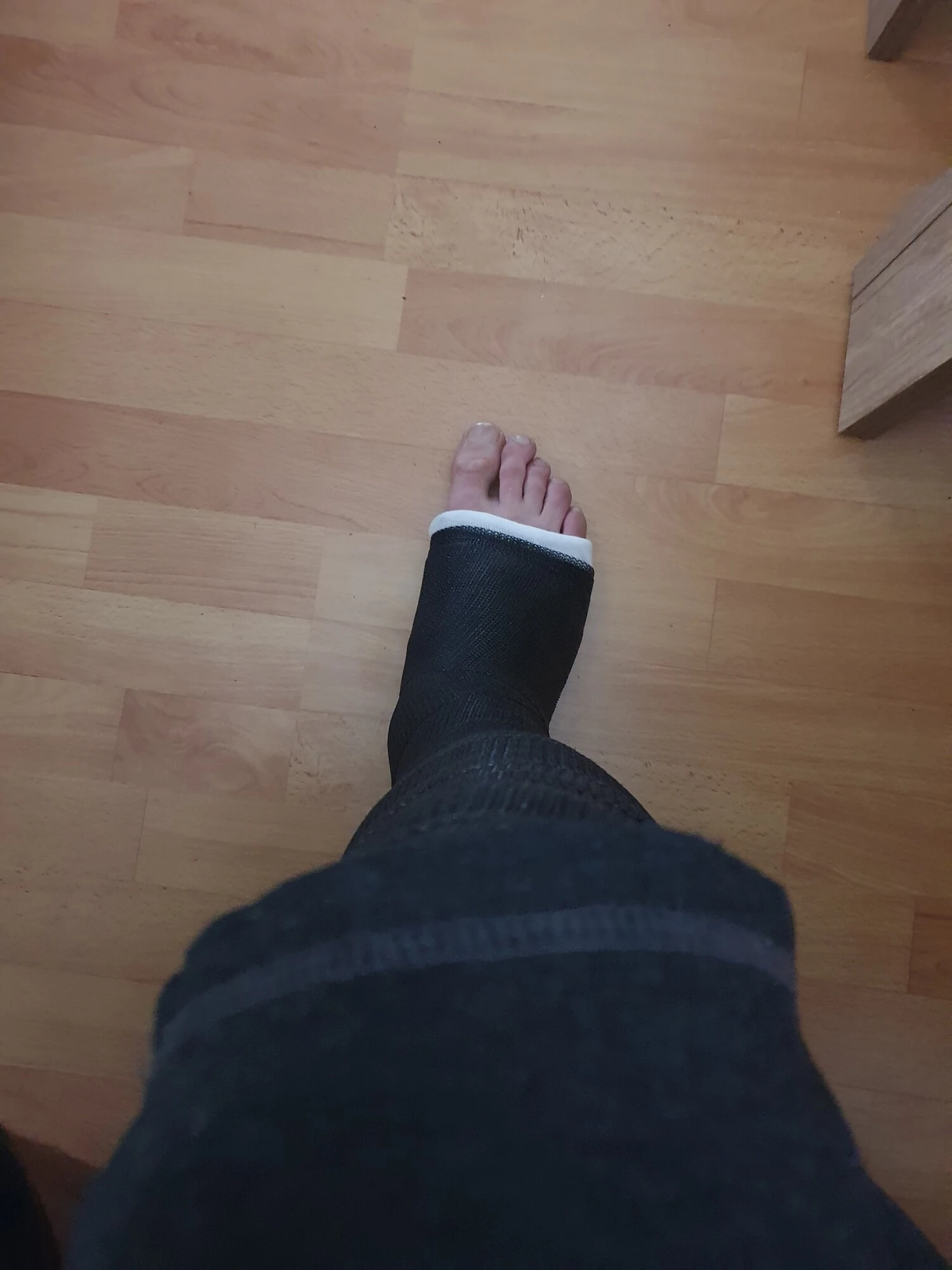 my long leg casts