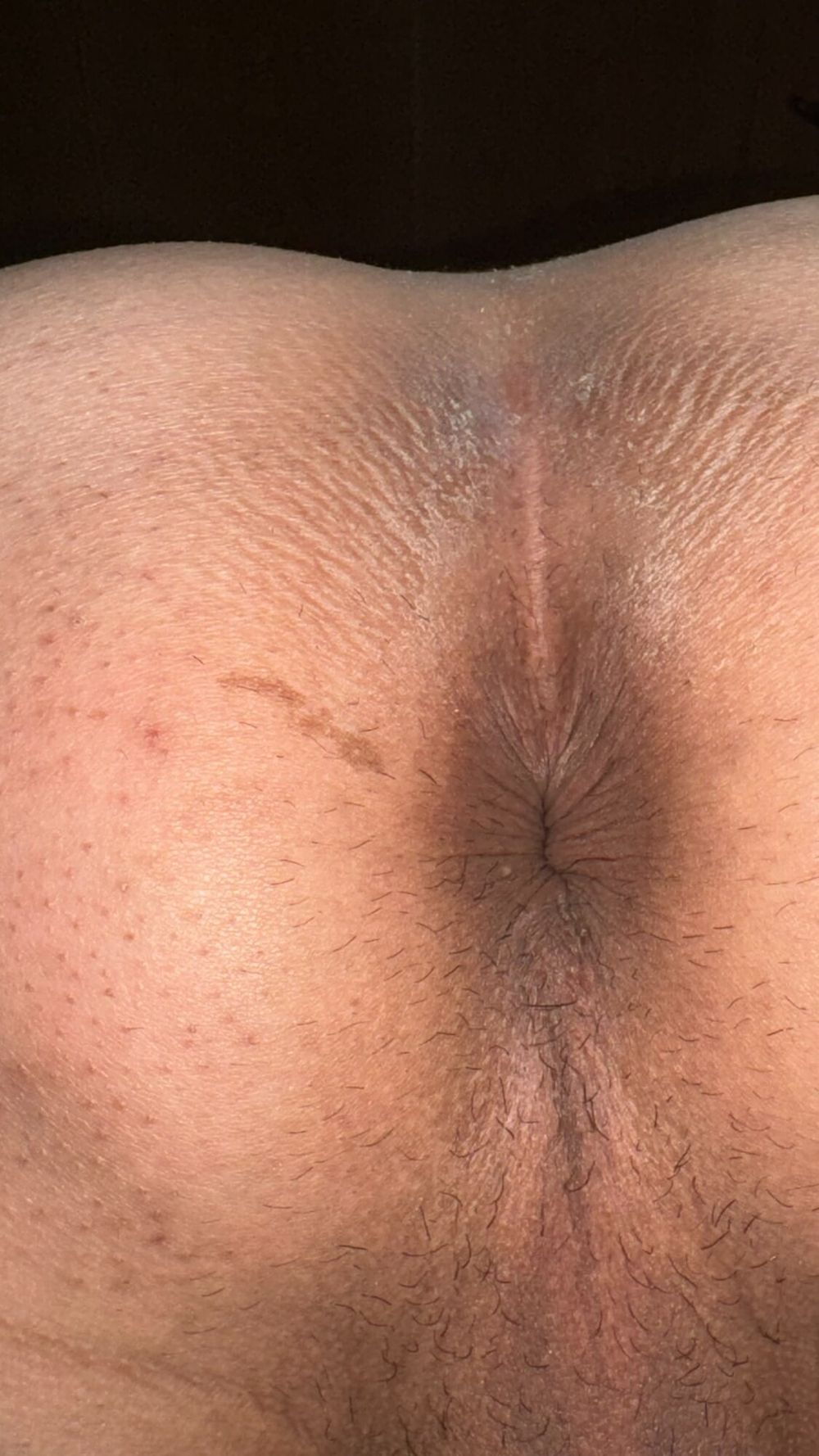 my  anus #39