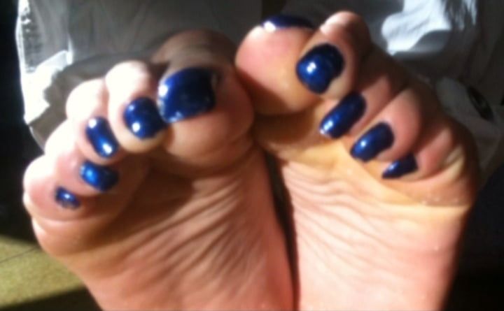 Blue toenails under sun ray #32