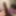 mon sexe circoncis?