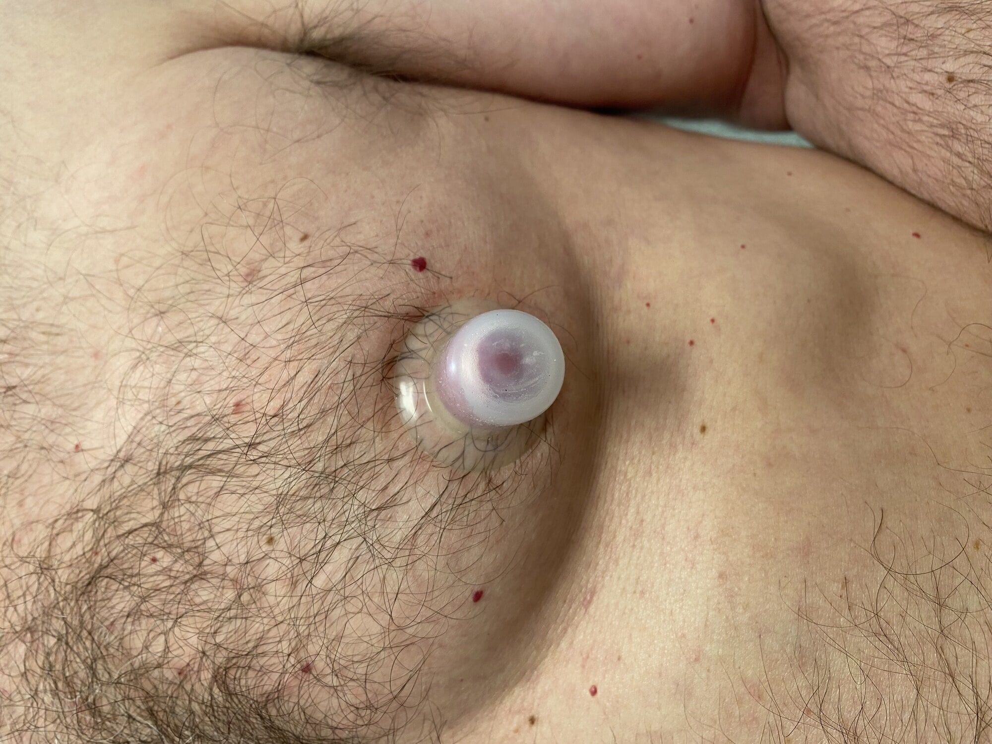 Nipple stretching with suctioning 