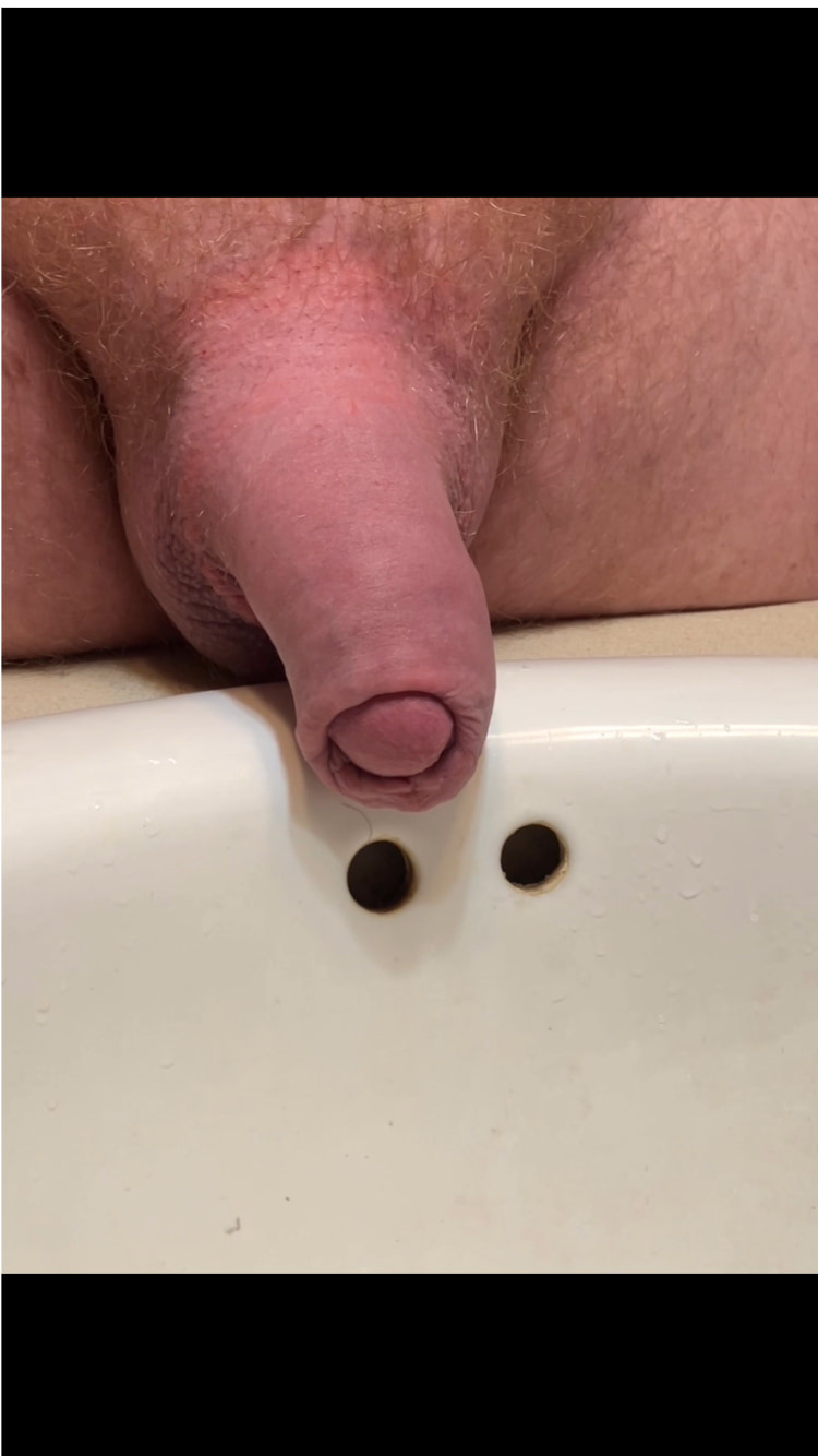Several pics of my uncut cock #57