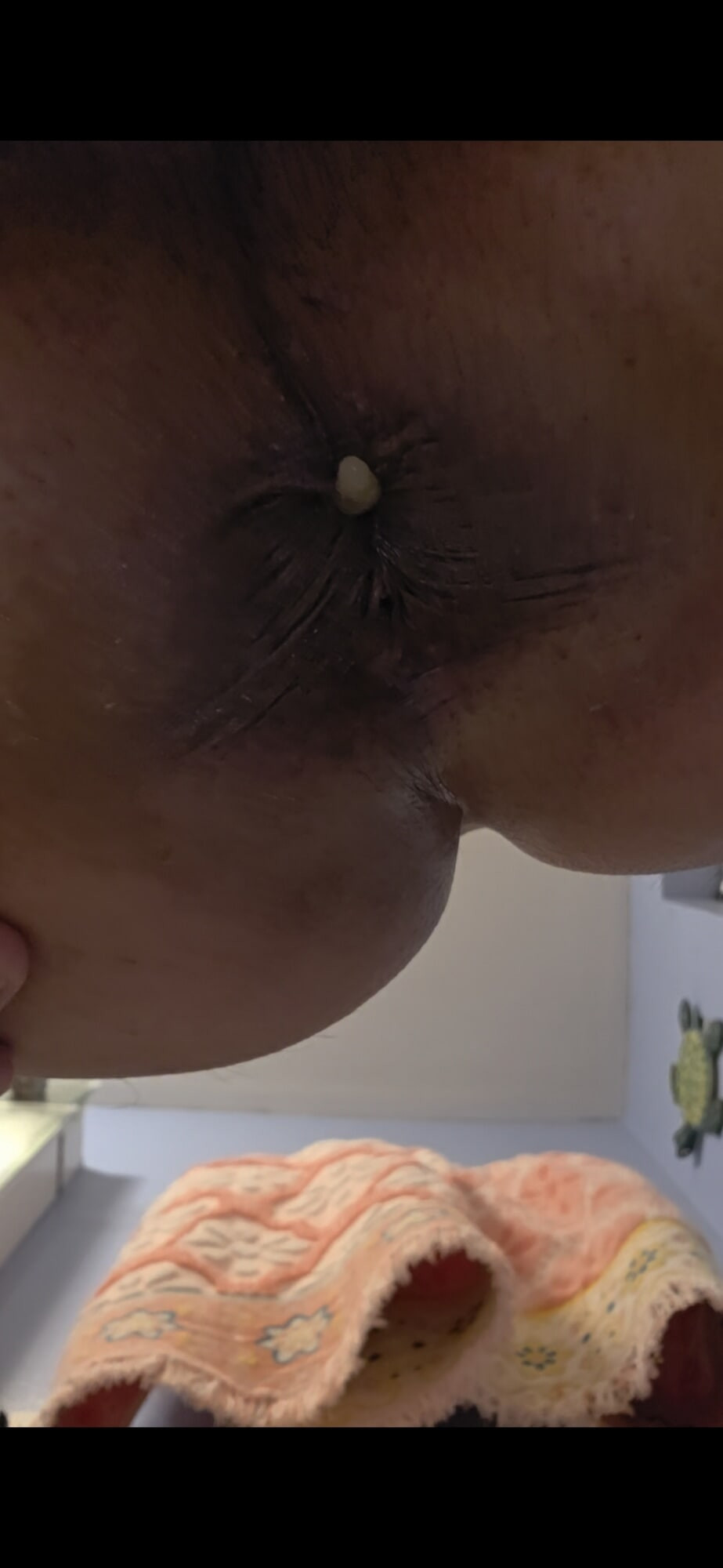 Asspussy Internal View and Gape #20