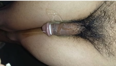 Today a white liquid came out from my dick.