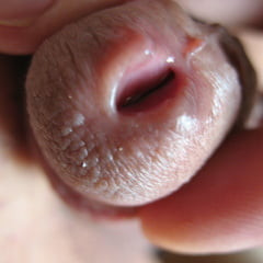 Open peehole