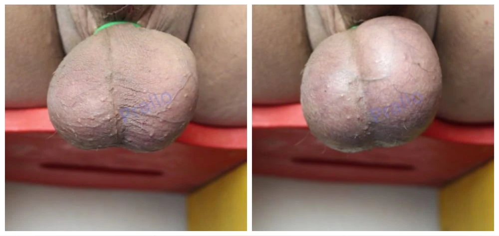 Blue Balls #14