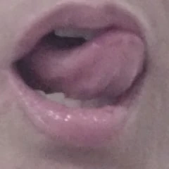 Teaser