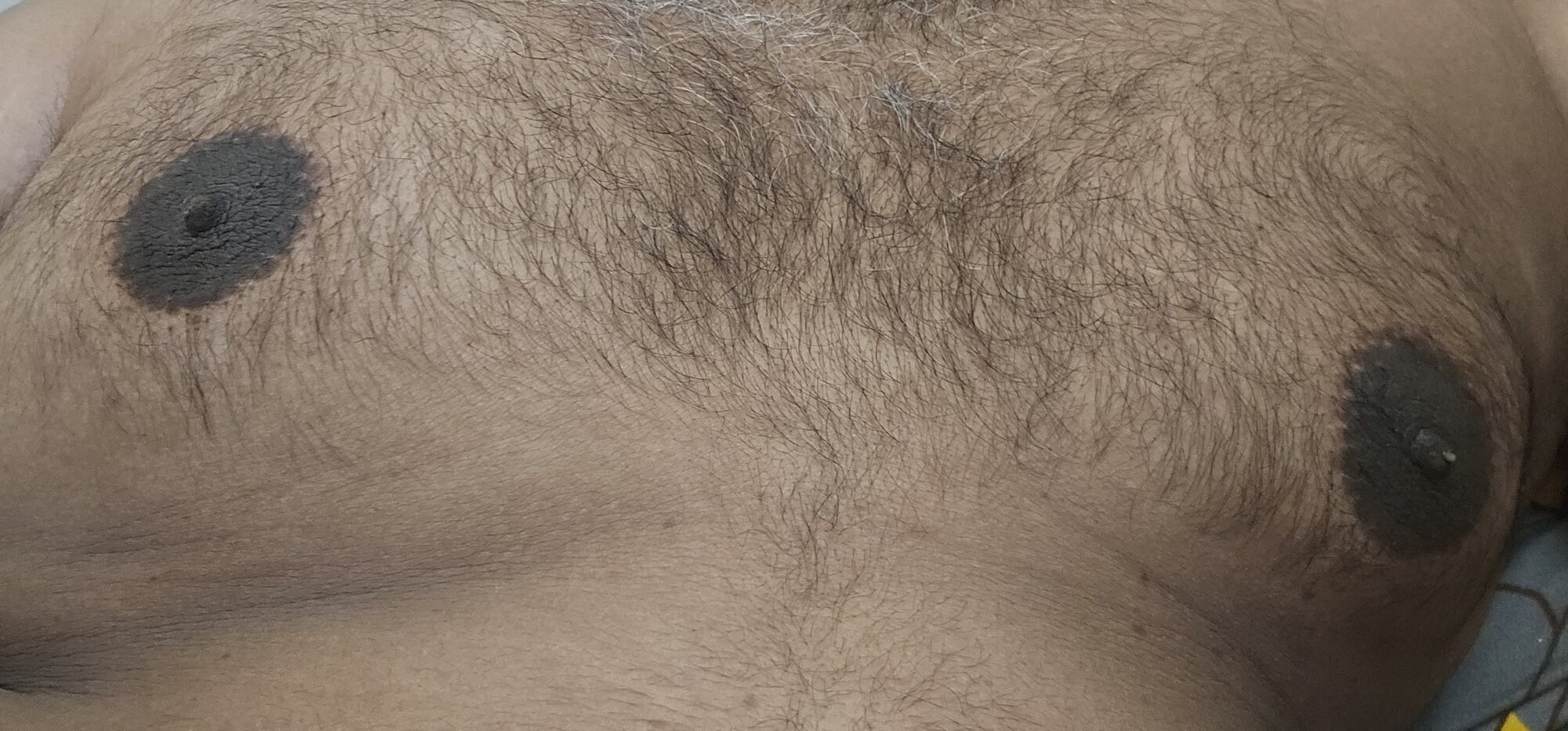 Nipples