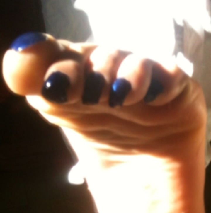 Blue toenails under sun ray #27