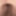 My gaped hole #5