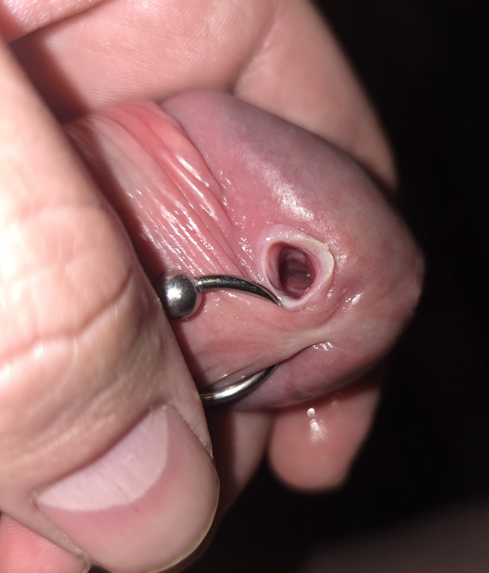 Stretching my second peehole to fit an 8mm piercing #3