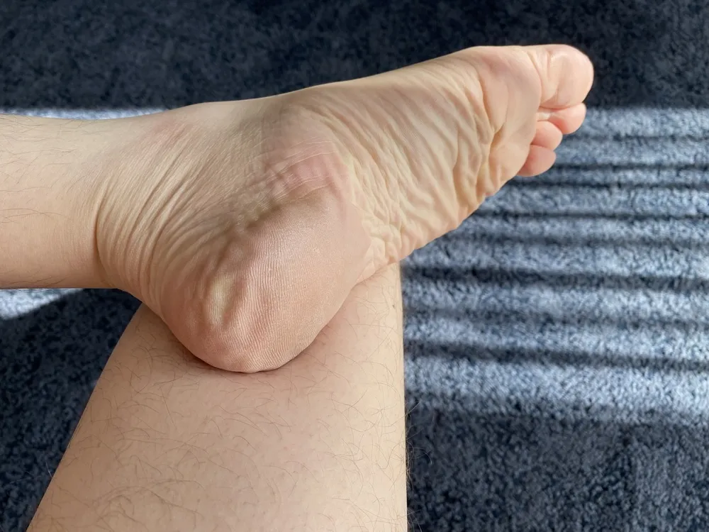 My beautiful male soles #11