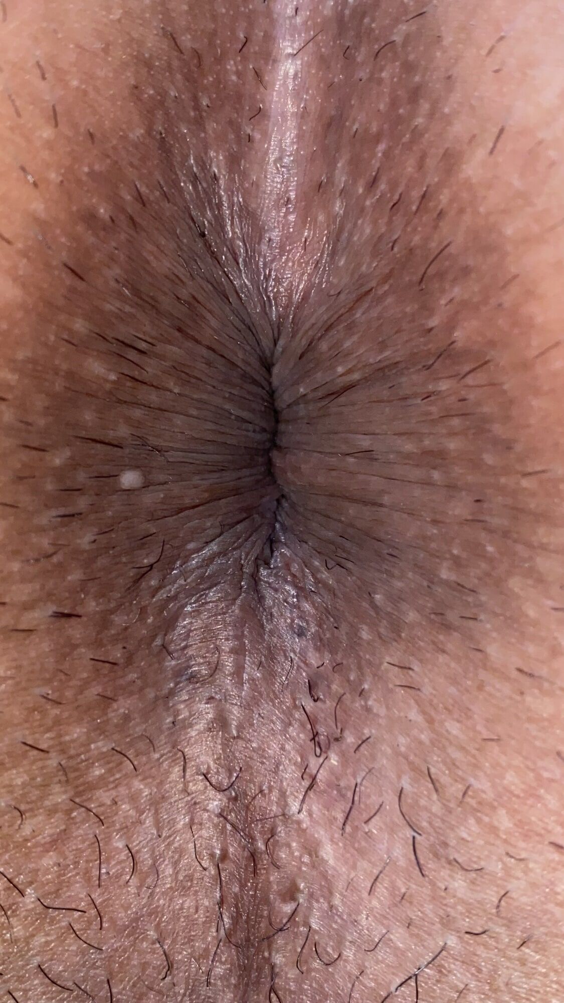 An image of my anus that is clear to every single wrinkle #58