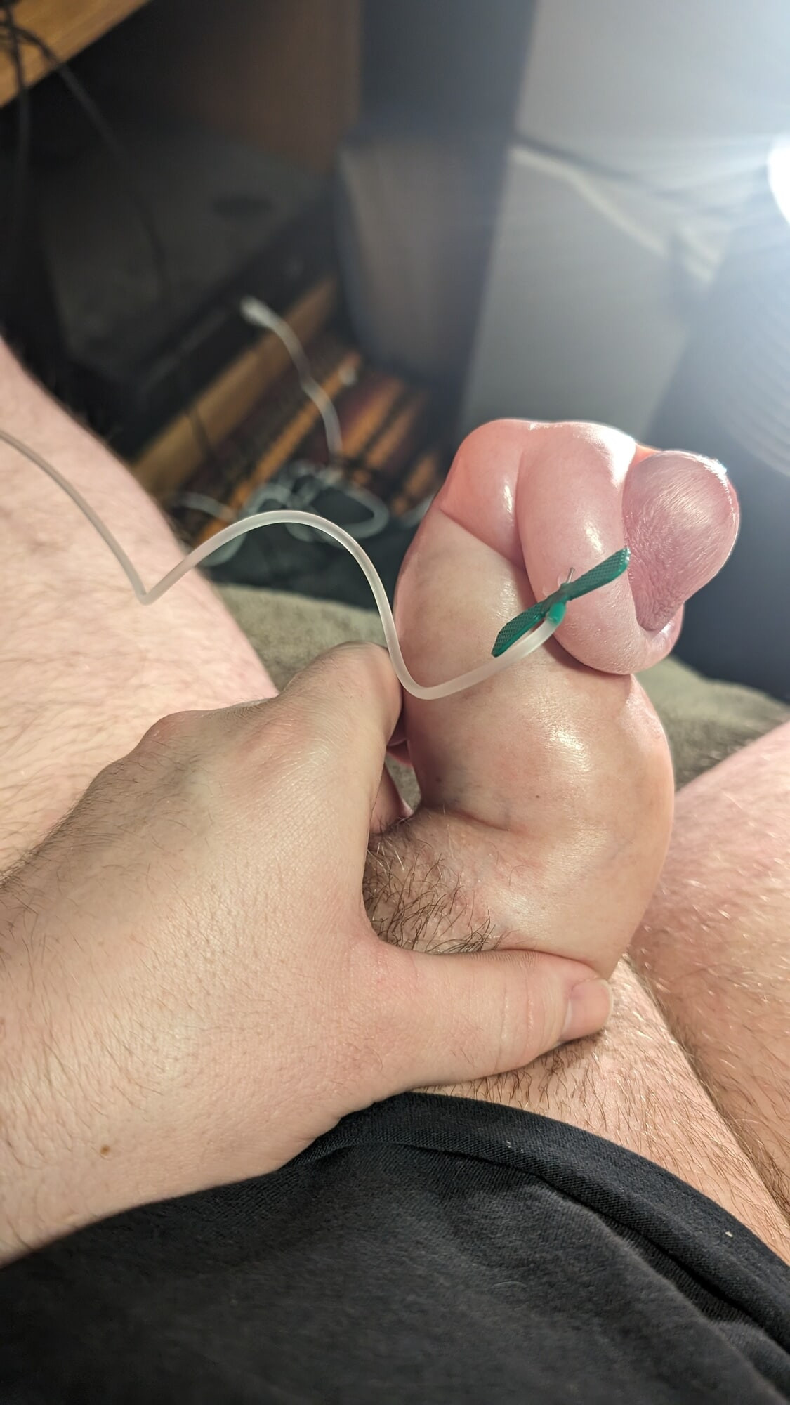 Saline Foreskin
