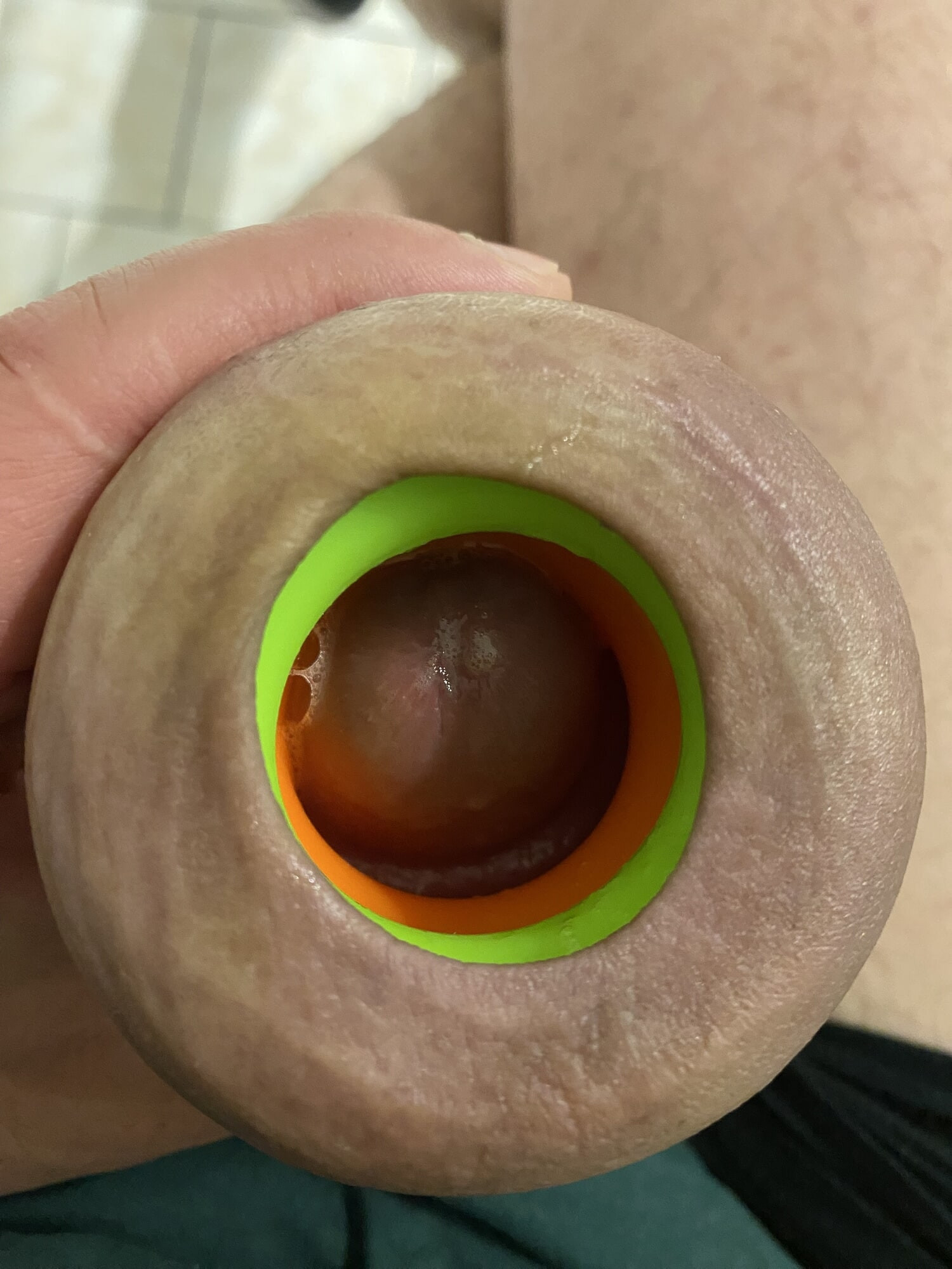 Prepúcio esticando anel de donut